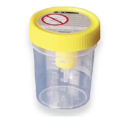 CONTENITORE URINA STERILE MEDIPRESTERIL CON SISTEMA TRANSFERT PER PROVETTE SOTTOVUOTO - Speedyfarma.it